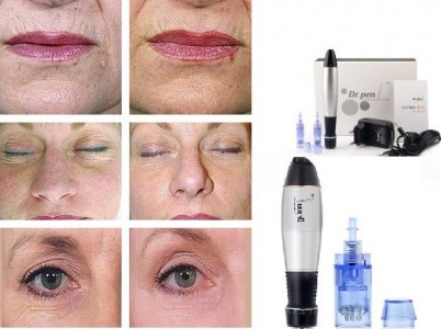 derma-roller-for-wrinkles