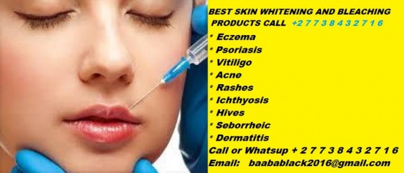 Skin specialist +27738432716